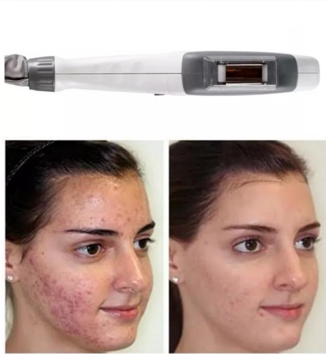 Zemits Light Expert 2.0 IPL Laser Maskin