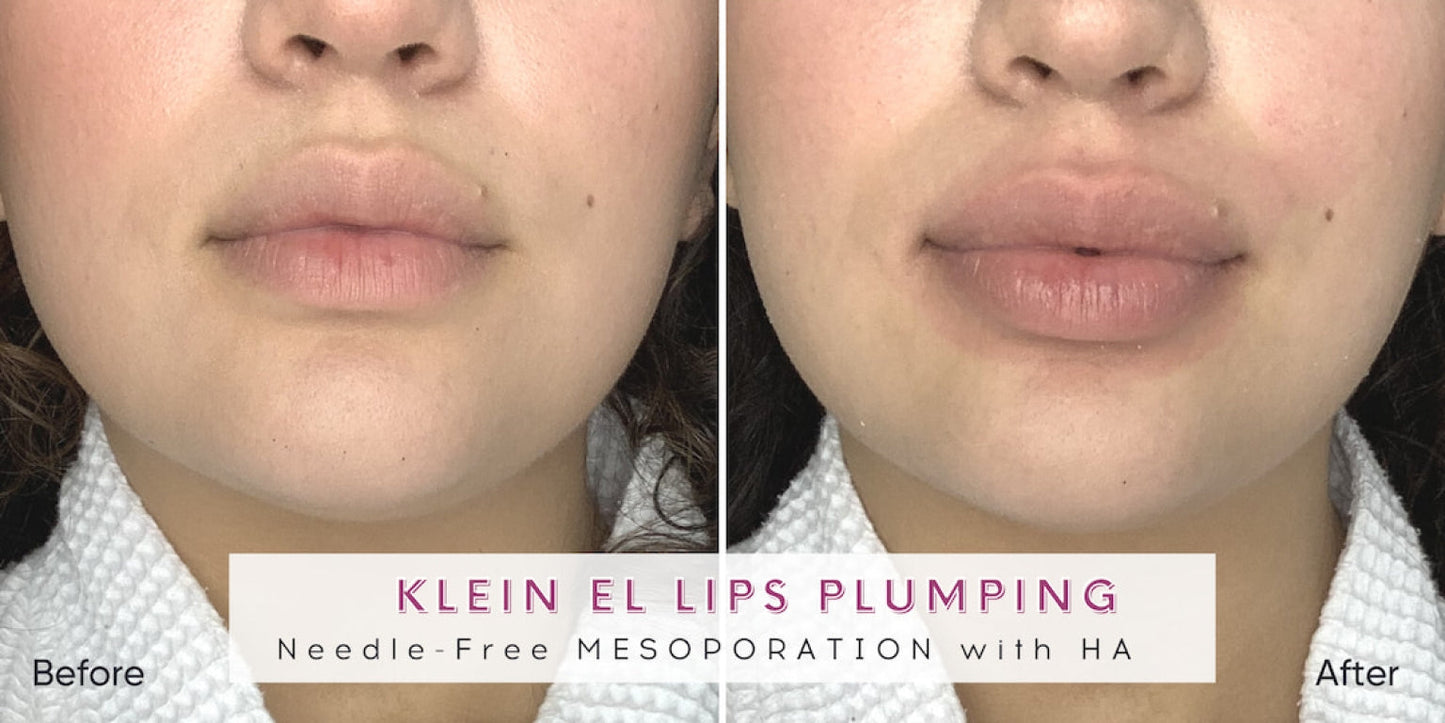 Zemits Klein EL Elektroporationssystem