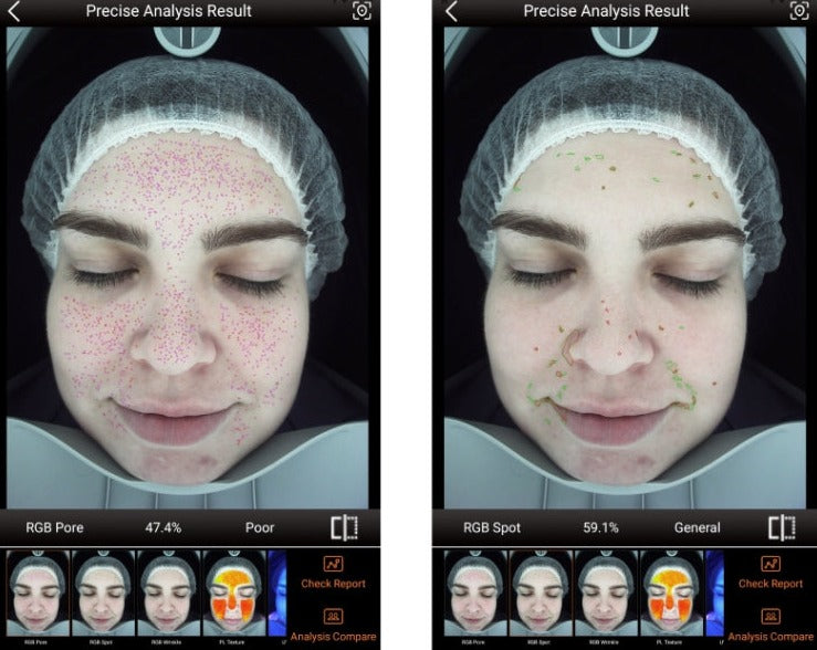 Zemits VeraFace Hudanalys System