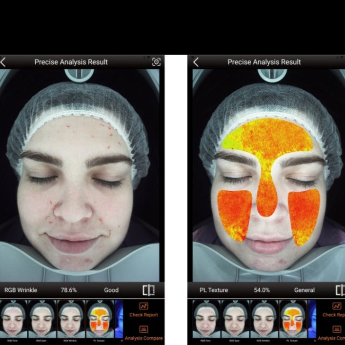 Zemits VeraFace Hudanalys System