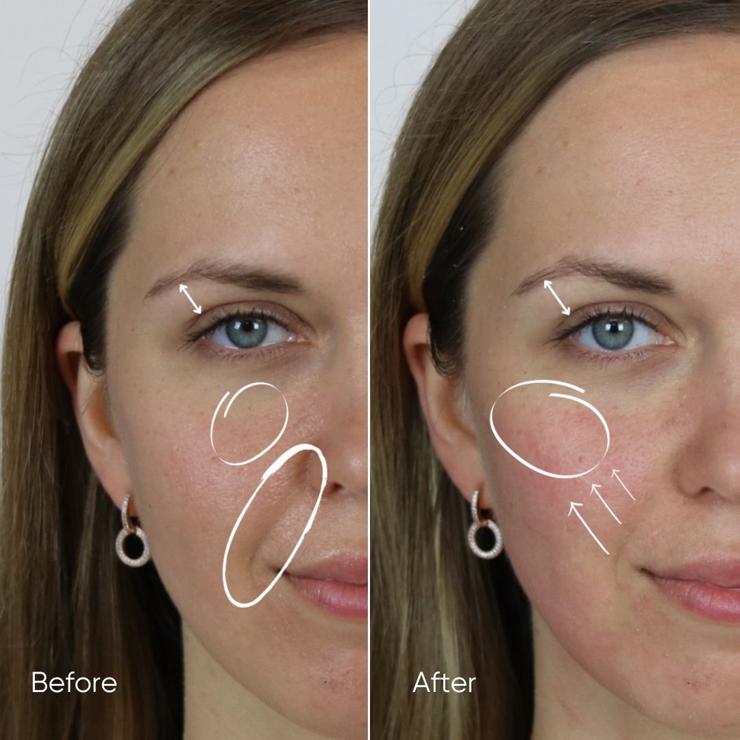 Zemits HydroVerstand PRO 7-i-1 HydroDiamond™ System