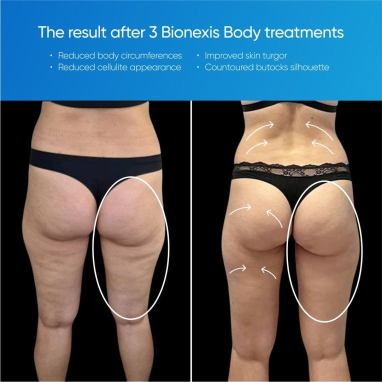 Zemits Bionexis Lite Pro Kontureringssystem